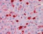S100A9 / MRP14 Antibody (Internal)
